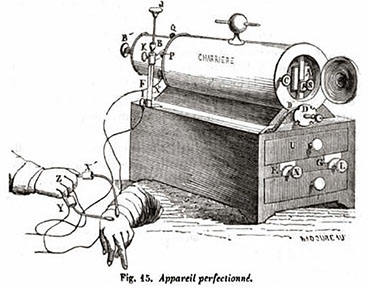 Afecta en mayor medida a los niños que a las niñas, porque el gen de la distrofina se encuentra en el cromosoma X